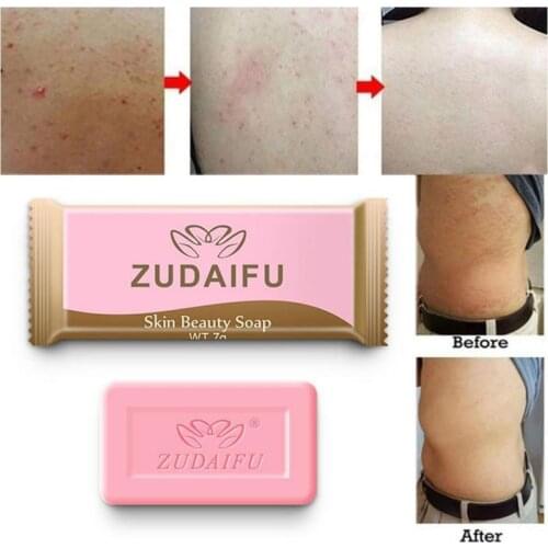 1 Bags Portable Sulfur Soap Skin Deep Cleaning Oil Acne Seborrhea Antifungal Bath Soap Anti-mite Soap Back Mites Removal Soaps