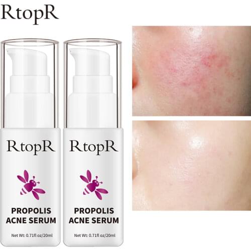 2 pcs RtopR Propolis Oil Control Acne Serum Repair Acne Scar Cleansing Serum Shrinkage Elimination Acne Treatment Moisturizing