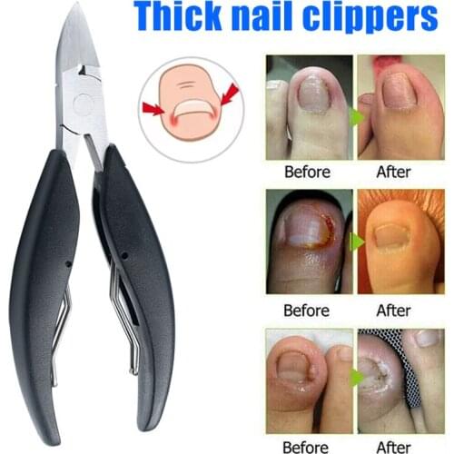 Toenail Clippers for Thick Ingrown Toe Nails Heavy Duty Nail Scissor Cut Toenails Tools _WK