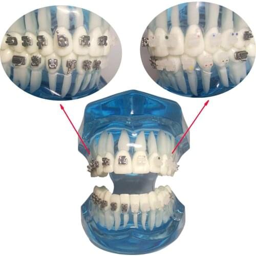 1 Piece Dental Orthodontic Teeth Model Self-ligating/Ceramic Brackets Contrast with Buccal Tubes