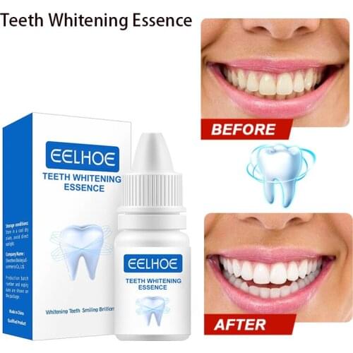 Baileton Products For Teeth Whitening