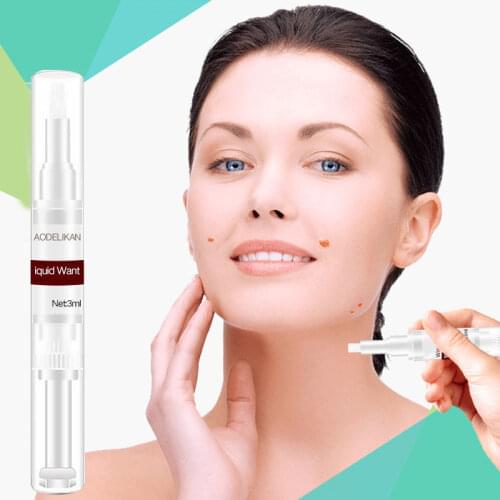 Wipe Off Tags Moles Remover 3ml Skin Tags Mole Remover Effective Formula for Skin Tags Removal Women Girl Skin Care