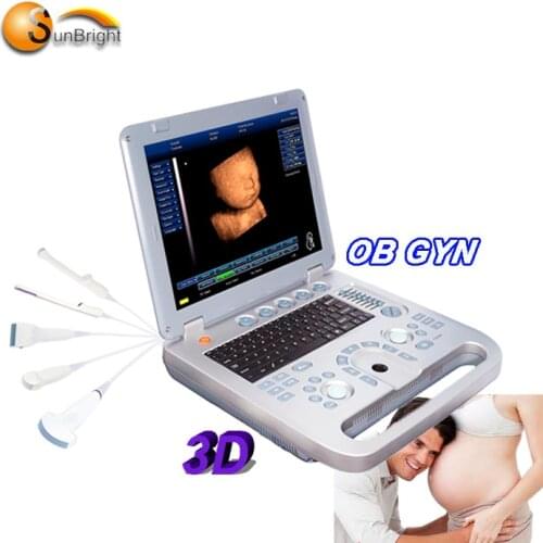 Medical Portable 3D Echo OB GYN Baby Pregnancy ultrasound bone densitometer