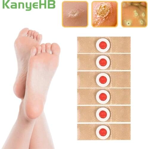 30pcs Foot Care Medical Plaster Foot Corn Removal Calluses Plantar Warts Thorn Plaster Health Care Pain Relief Pads Patches A175