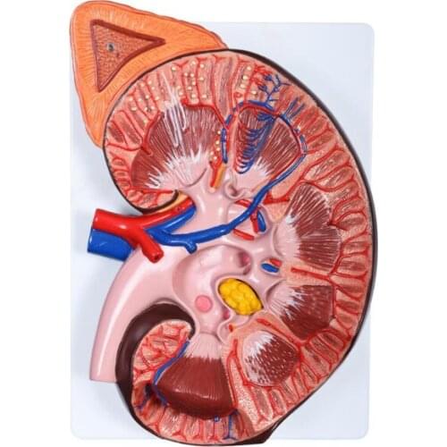 Medical Science Subject Anatomical Series Enlarged Kidney Model 1 Part for Teaching