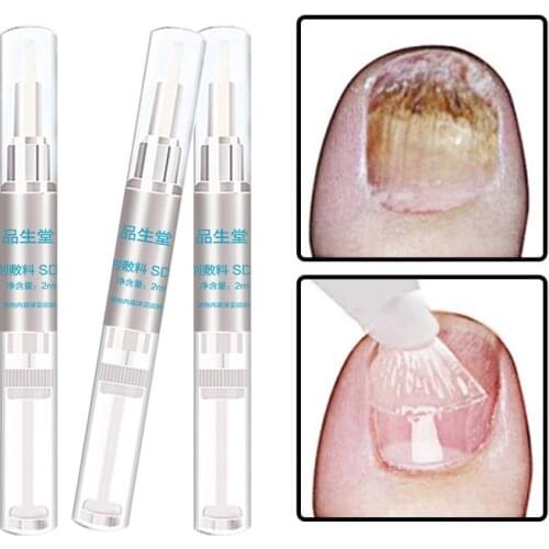 3ML Pro Nail Fungus Treatment Nail Oil Pen Anti Fungal Nail Cuticle Remover Liquid Nail Growth Skin Care Dropshipping