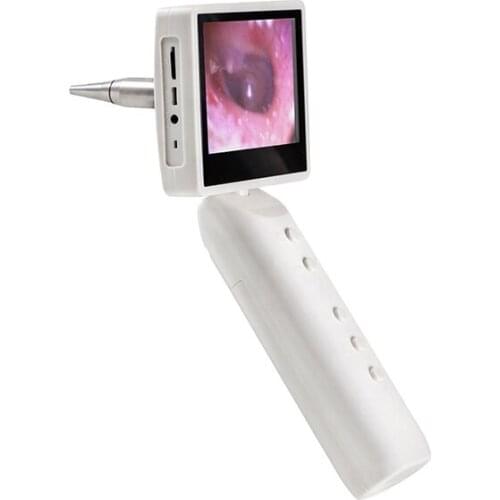 IN-S1 handheld digital video ear otoscope