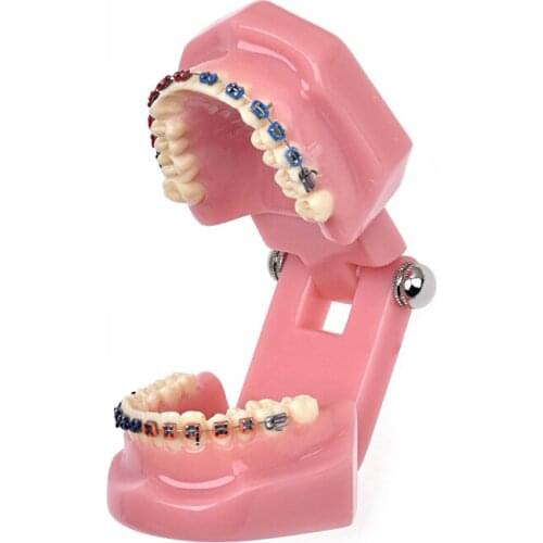 1pc Dental Tooth Model Orthodontic Study Model Teeth Orthodontic Model With Metal Brackets For Dental Lab Teaching and Research