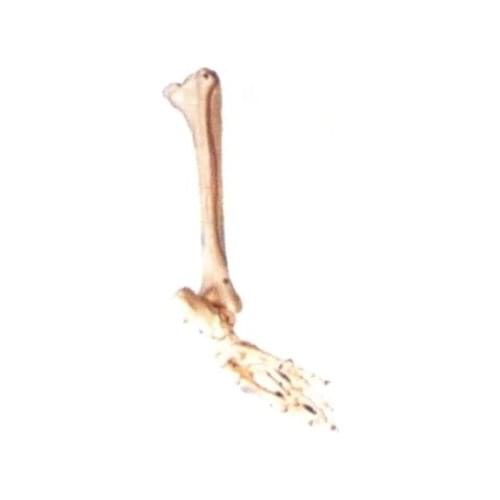 Bones of foot fibula tibia model Medical orthopedics teaching simulation natural size free shipping
