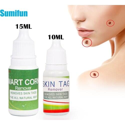 2Types Skin Tag Remover Wart Treatment Papillomas Removal Liquid Against Moles Remover Anti Verruca Remedy Ointment 10/15ML