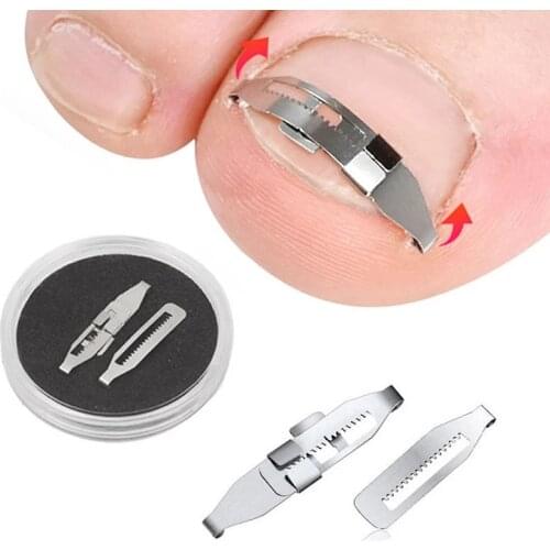 10Pcs Ingrown Pads Foot Care Toe Nail Ingrown Correction Sticker Repair Pedicure