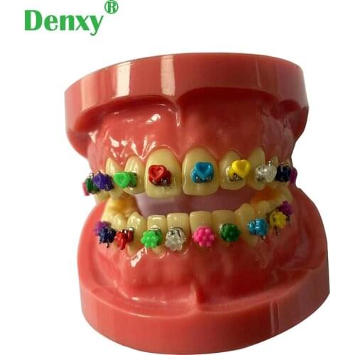 320pcs/pack Dental orthodontic Fashion Cartoon Tie Cute Ligature Tie Orthodontic ligatures Elastic Tie O tie Orthodontic Bracket