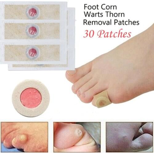 30 PCS Foot Care Sticker Medical Patch Corn Removal Pads Warts Thorn Curative Patches Calluses Remove Callosity Detox