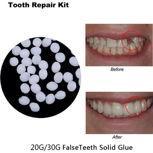 20g/30g Temporary Tooth Repair Kit Teeth And Gaps FalseTeeth Solid Glue Denture Adhesive Teeth Whitening Tooth Beauty Tool