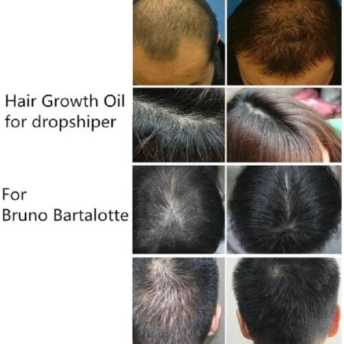 Andrea Hair Growth Ginger Oil Natural Plant Essence Faster Grow Beard Eyelashes Hair Tonic Shampoo Hair Loss Product