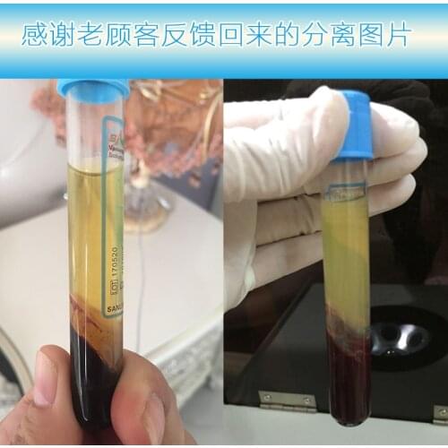 PRP Cosmetic 8ml Disposable Negative Pressure Vacuum Aseptic Serum Separation 4 pc/pack PrP Blood Collection Tube
