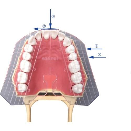 1 Piece Dental Guide Plate Of Teeth For Professional Dental Application Only Help Effective Teeth Arragement In Right Place