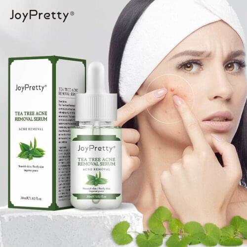 JoyPretty Tea Tree Acne Serum Face Serum Plants Reduce acne spots Acne Serum Smooth Skin Fades Acne Marks Face Skin Care TSLM1