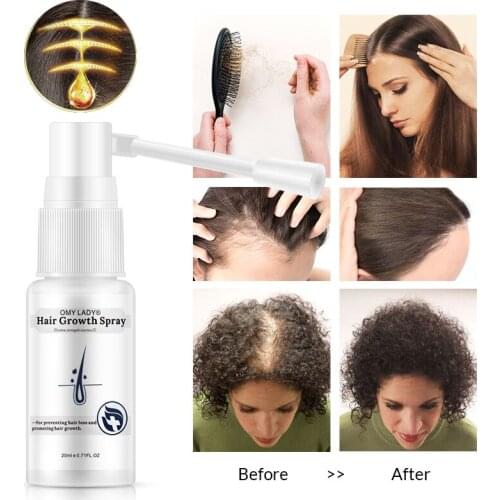 OMYLADY Hair Care Hair Growth Essential Oil Original Authentic 100% Hair Loss Liquid Care Beauty Hair Growth Spray