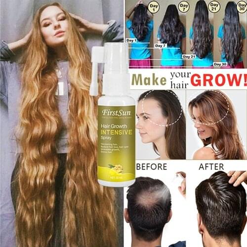 30ml Ginger Hair Growth Essence Spray Hair loss Treatment Preventing Hair Loss spray hair Growth Essence Hair Care