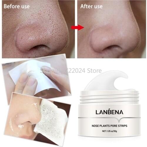 LANBENA Blackhead Remover Nose Mask Pore Strip Black Mask Peeling Acne Treatment Deep Cleansing Face Mask Oil Control Skin Care