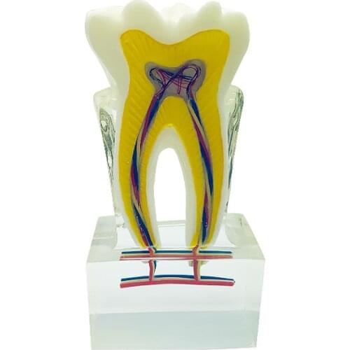 Teeth Model 6 Times Tooth Model with Nerves Dental Model Demonstration Model Dentistry Products