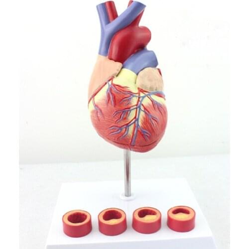 Life Size Human Heart Anatomy Model With 4 Stage Vascular Mounted on White Base Cardiac Learn