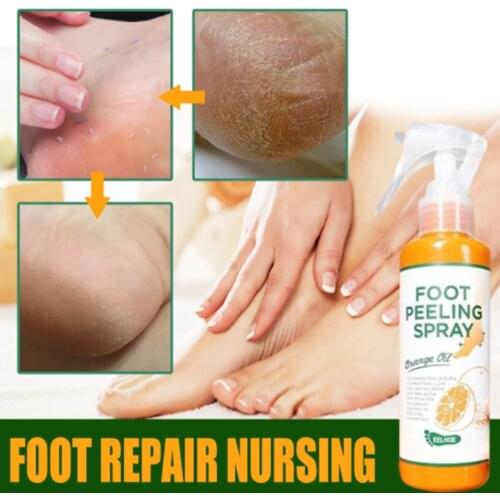 Foot Peeling Spray Natural Orange Essence Pedicure Hands Dead Skin Exfoliator Mask Whiten Foot Care Tool