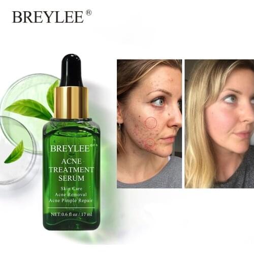 BREYLEE Anti Acne Repair Serum Facial Mask Tea Tree Oil Acne Pimple Scar Remover Essence Whitening Skin Care Beauty Products New