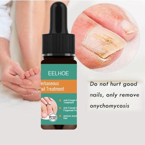 10/30ML Nail Repair Liquid Onychomycosis Removel Antibacterial Transparent Painless Mild Moisturizing Nail Care For Nail Foot