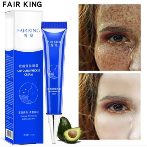 15ML Strong Effects Powerful Whitening Freckle Cream Remove Melasma Acne Spots Pigment Melanin Face Care Cream