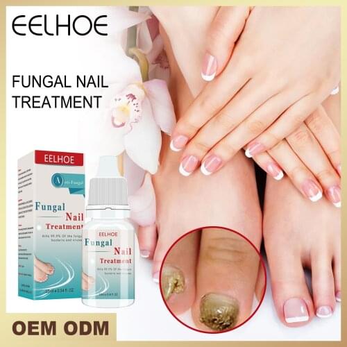 Масла для ногтей Eelhoe China At AliExpress