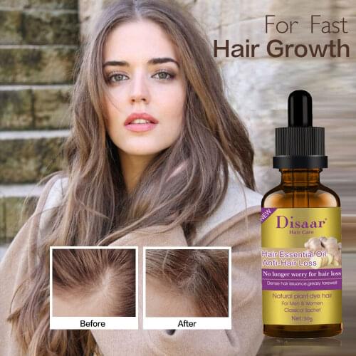 Fast Hair Growth Essence Oil Hair Treatment Anti Hair Loss Help for Men Women Hair Growth Hair Care Product Liquid 30ml