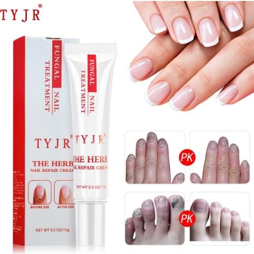 Fungal Nail Repair Cream Herbal Nail Fungus Curve Treatment Anti Bacteria Onychomycosis Paronychia Anti Fungal Toenail Care