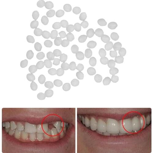 Fake Teeth Denture Adhesive Solid Glue Dental Restoration Temporary Tooth Repair for Decoration Solid Glue Denture Adhesive