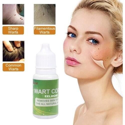 Mole Elimination Potion Skin Dark Spots Remover Lighten Melanin Face Essential Oil Serum Facial Acne Repair Skin Care