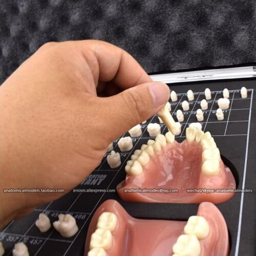 CMAM/12618 Dental- tooth prepare guide, Human Oral Dental Medical Teaching Anatomical Model