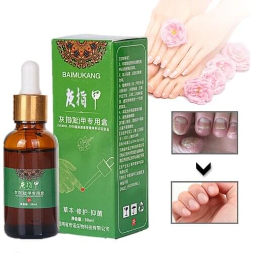 2021 New Nail Repair Promote Regrow Nail Care Nail Essence Anti Infection Paronychia Leuconychia Toe Nails Removal Gel