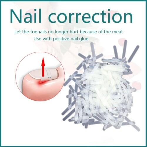 10pcs Straightening Clip Brace Pedicure Tool Ingrown Toenail Correction Tool Ingrown Toe Nail Treatment Elastic Patch Sticker