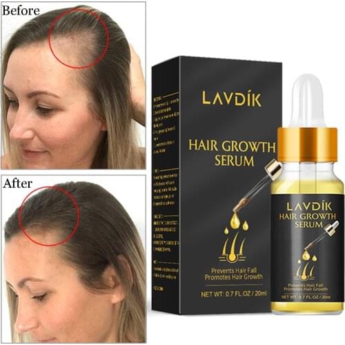 Plant Extract Hair Growth Essence Oil Nourishing Repairing Care Damaged Hair Serum Women Men Hair Loss Treatment Oil 20ml