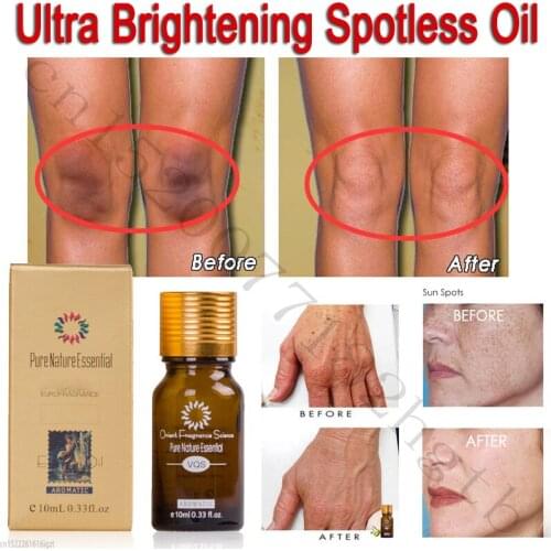 10ML Pure Nature Essential Ultra Brightening Spotless Oil Skin Care Dark Spots Remove Ance Burn Strentch Marks Scar Face&Body