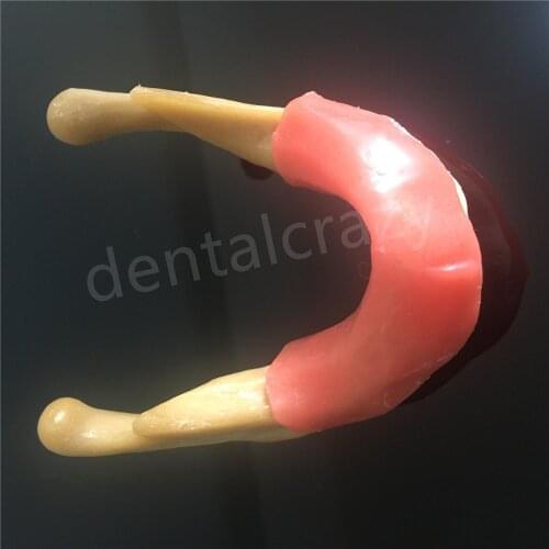 Dental Silicone Mandible With Soft Tissue for Dental Implant Model Training Tool Dental