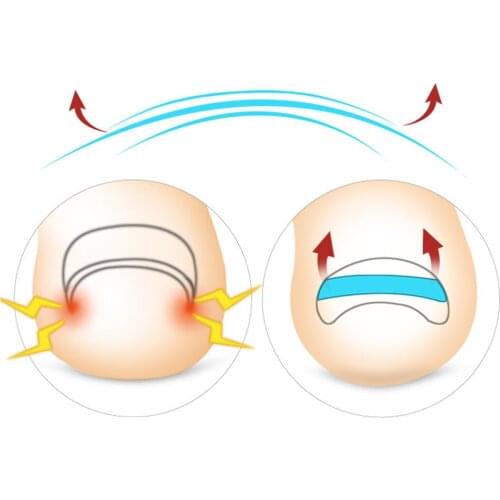 Professional Strong Ingrown Toenail Set Long-Lasting Tools for Nail Correction Curved Toenails Foot Care Home Use Salon Seniors