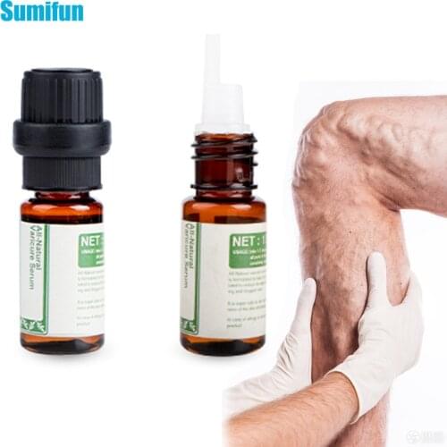 10ml Varicose Veins Oil Serum For Legs Care Vasculitis Phlebitis Spider Cream Varicosity Angiitis Removal Oil