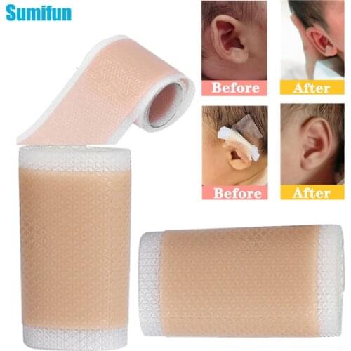 2Pcs Baby Ear Corrector Comfortable Breathable Silicone Tape Infant Protruding Ears Correction Ear Concealer Corrector Ear Care