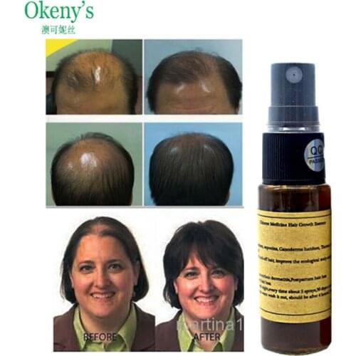 Okenys Yuda Pilatory EXTRA STRENGTH, 7 Days Hair Regrowth Thickener, Faster Hair Growth Hair Treatment Original 20ml Spray