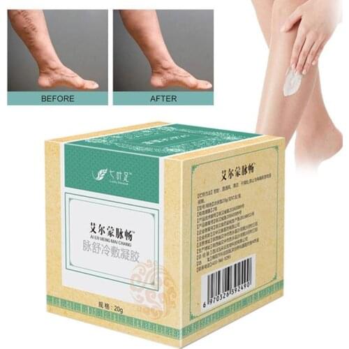 1pc Effective Varicose Vein Cream 20g Spider Veins Treatment Chinese Herbal Medicine Varicose Veins Ointment Leg Health Care
