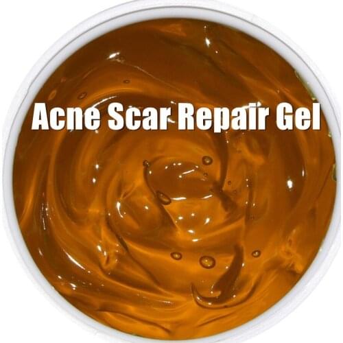 Repair Gel Pockmark Acne Scar Repair Pigmentation Corrector Shrink Pores After Sun Repair 1000g