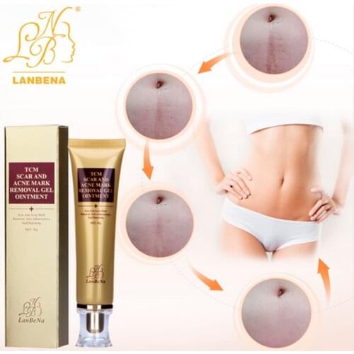 Body Scub Repair Ginseng Body Cream for Stretch Marks Acne Scar Remove Body Bleaching Creams Moisturizing Skin Repair Cream