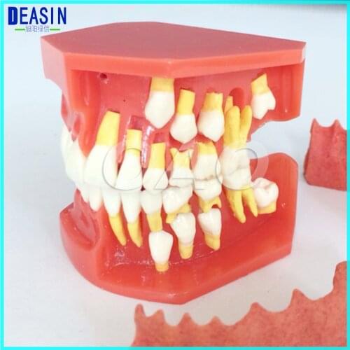 Dental Tooth Teaching Model Children Permanent Tooth Alternative Model Deciduous Teeth Removable Demonstration For Kids Studying